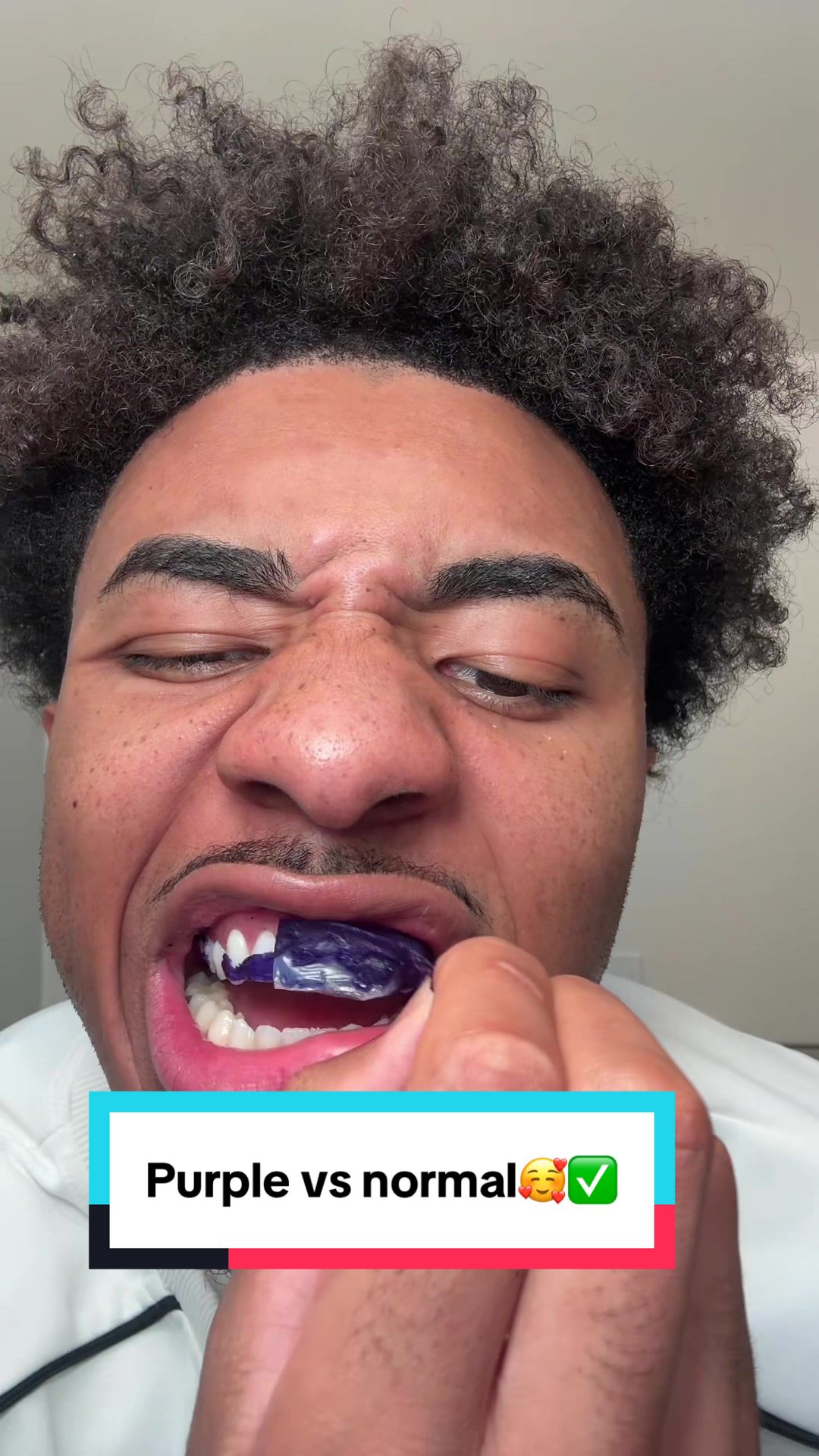 Who will win and who will lose!#tiktokshopcreatorpicks #whiteningstrips #teeth #yellowteeth #drdent 