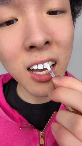 The difference is insane ngl!! #teethwhitening #mouthwash #drdent 