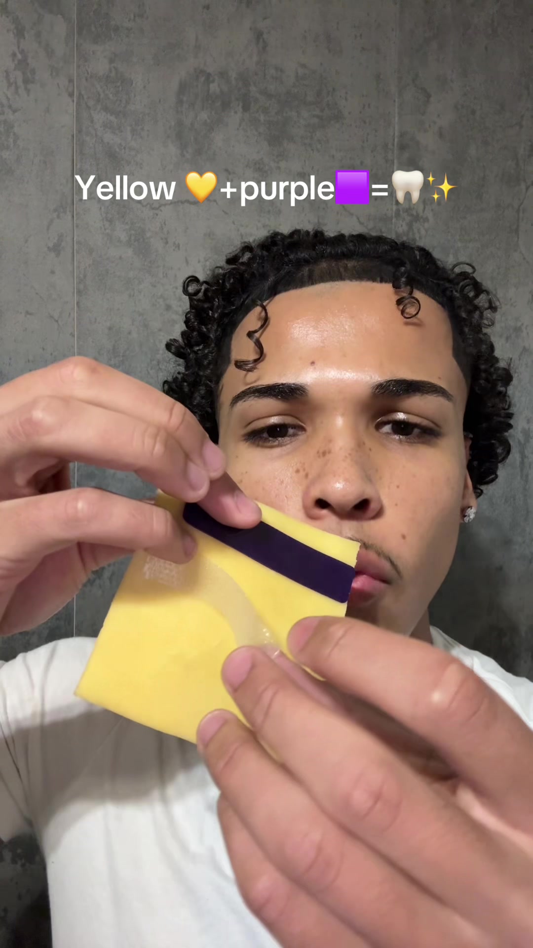 Veneers who ??? #whiteningstripes #drdent #tiktokmademebuyit #yellowteeth