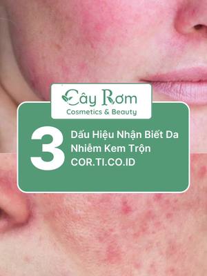 3 dấu hiệu nhận biết da nhiễm kem trộn Cor.ti.co.id #cayromcosmetic #goclamdep #beautytips #kemtron #corticoid #beautyreview #learnontiktok 