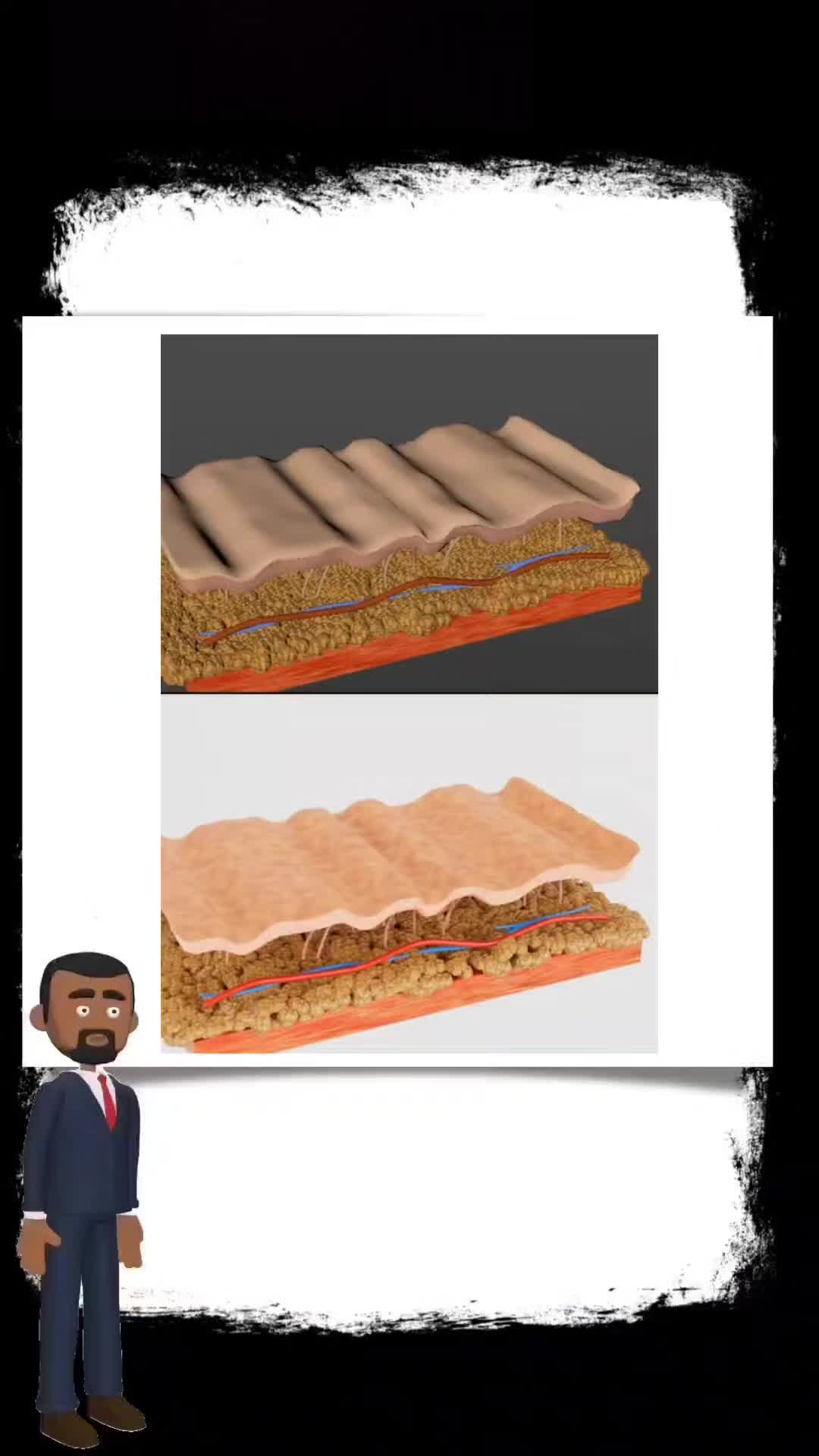 glutathione BIYODE #glutathione #glutathionegummies #glutathionebiyode 